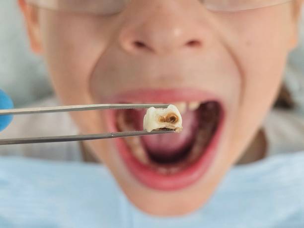Best After-Hours Emergency Dentist in Hampden Sydney, VA